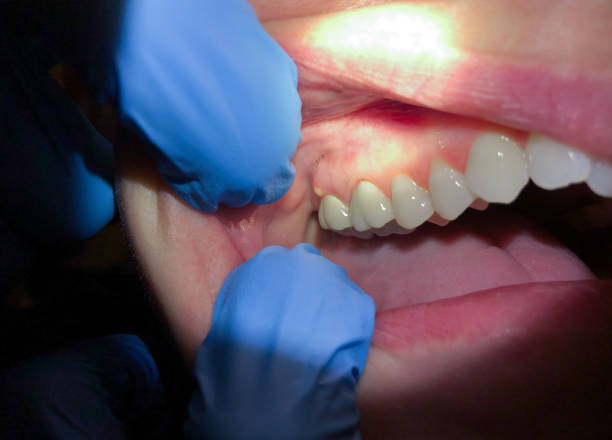 Best Emergency Root Canal Treatment in Williamston, MI