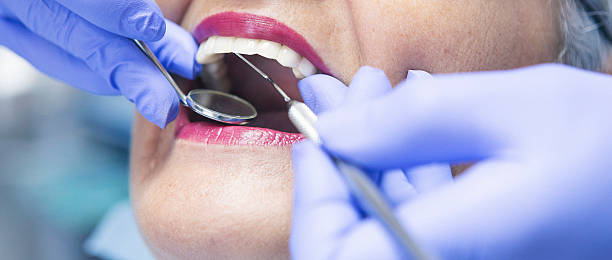 Best Emergency Dental Care for Broken or Chipped Teeth in Williamston, MI